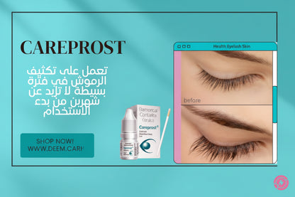 Careprost – Bimatoprost Ophthalmic Solution 0.03% | كيربروست سيروم لتطويل وتكثيف الرموش
